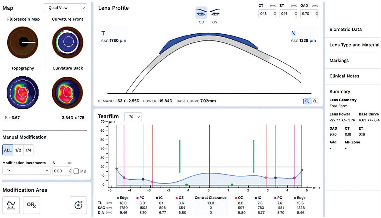 NO FEE CE WORST CASE SCENARIOS Contact Lens Spectrum